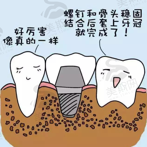 河南大学淮河医院口腔科有牙齿种植吗？效果如何？分享案例+医院信息