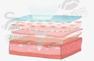 光子嫩肤有什么作用?有哪些优点