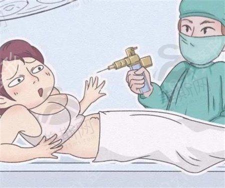腹部吸脂有效吗？腹部吸脂不适合哪些人