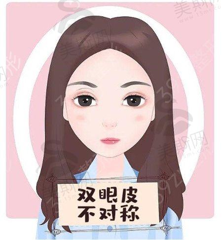 割双眼皮手术后应注意哪些事项
