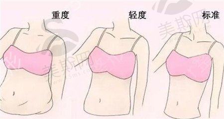 光纤溶脂后会留疤吗？有哪些后遗症
