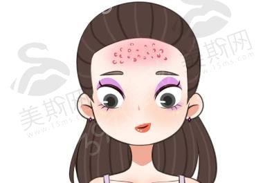 光子嫩肤安全吗，有哪些适应症