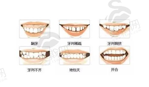 内蒙古自治区医院口腔科牙齿矫正怎么样？医院简介+详细案例在线浏览