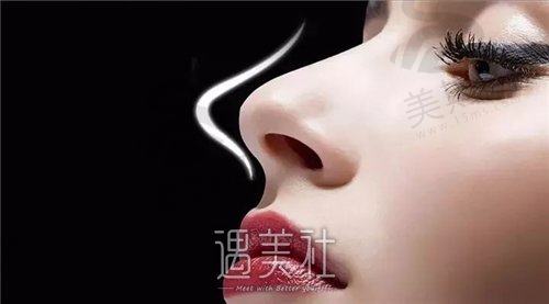 处理眼部细纹的好方法都有什么呢？专业医生告诉你