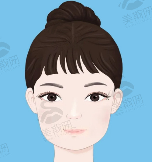 武汉大学中南医院医疗美容科双眼皮手术怎么样？口碑技术在线点评，附案例图片分享