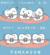 牙齿矫正12.png