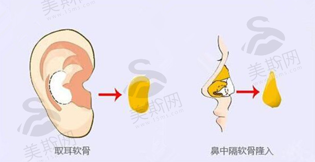 芜湖兰华整形医院做鼻子好吗？医院资料+真实案例+医院点评