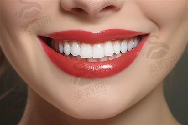 北京意达德贤口腔门诊部牙齿美白现价680元起，原价980元起，助您展现自信微笑，优惠力度不容错过！