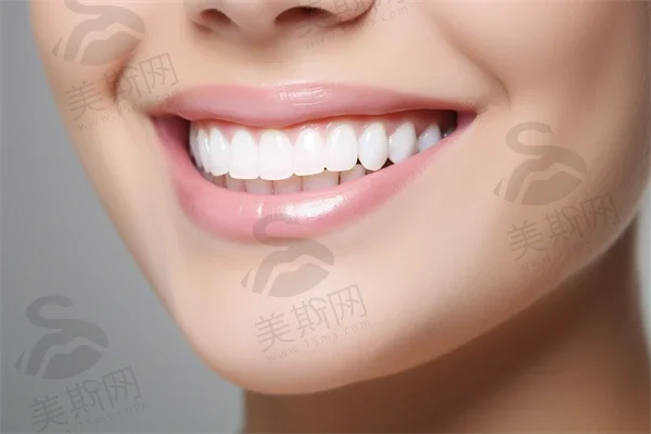 八、总结:为什么6980元起的瑞士ITI四级钛LSA种植牙值得选择?