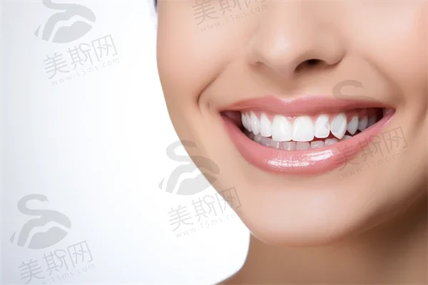 格莱美全瓷牙冠3600元一颗值不值——价格构成与横向对比
