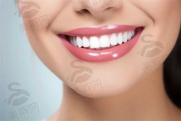 全瓷假牙:美观与功能的理想结合