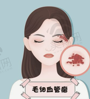 北京做乳晕漂红比较好的医院推荐，盘点这几家，强强来袭