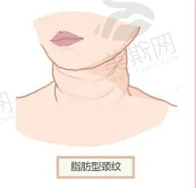 南京南京腰腹吸脂较好的整形医院是哪家？实力专家坐镇！优点对比~