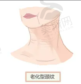 南京南京腰腹吸脂较好的整形医院是哪家？实力专家坐镇！优点对比~