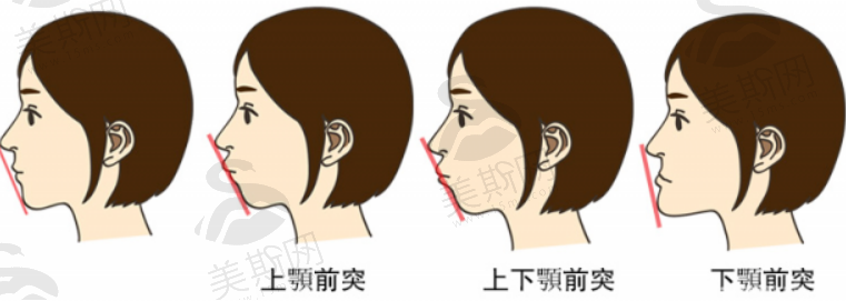 杭州做眼综合整形医院哪些靠谱？价格合适口碑不错的几家医院盘点！