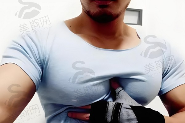 揭秘！男性女性化隆胸300cc效果大分享，附医院医生及价格信息