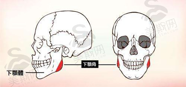 【真实分享】北京圣嘉新做下颌角截骨和劈外板手术脸型变化，矫正大小脸超成功！