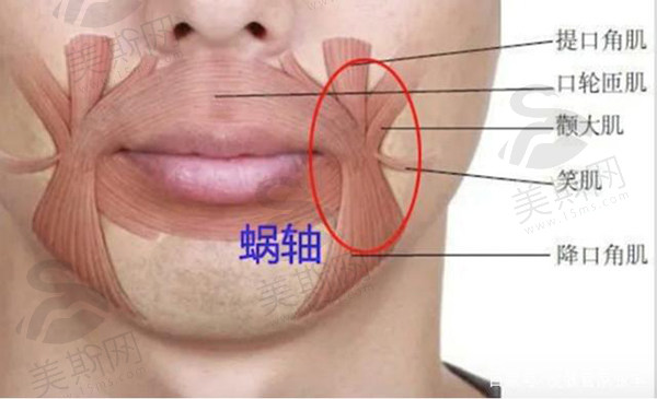 惊叹！成都素美医疗美容刘远程院长无痕筋膜提升2万元起，效果持久技术超赞！多实例见证口碑！