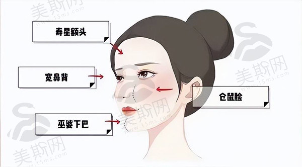 北京李方奇医生做面部减容29800起！皮贴骨效果超赞，技术优势在哪？能预约吗？
