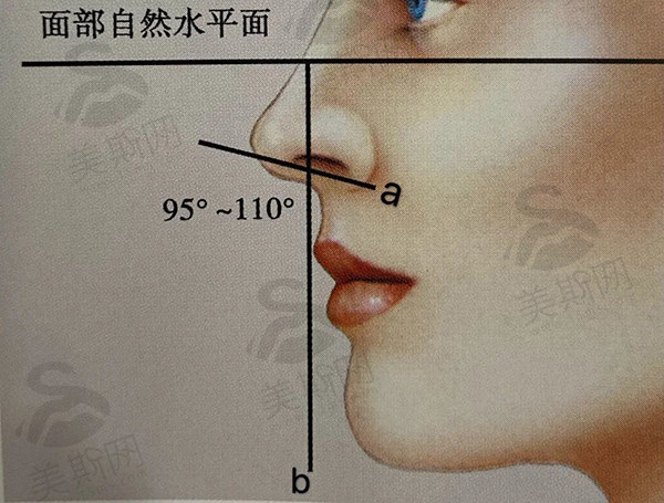 惊叹！牛克辉鼻子案例分享：在深圳艺星做bsk宫廷隆鼻，风格自然价格还实惠