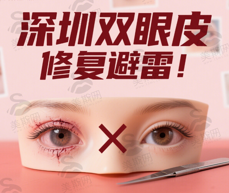 深圳双眼皮修复避雷！揭秘吕方中朱武根等5位专家排名及修复要点
