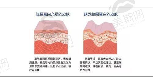 北京优梵医疗美容医院怎么样?含知乎评价、医生排名及艺术实体店地址揭秘