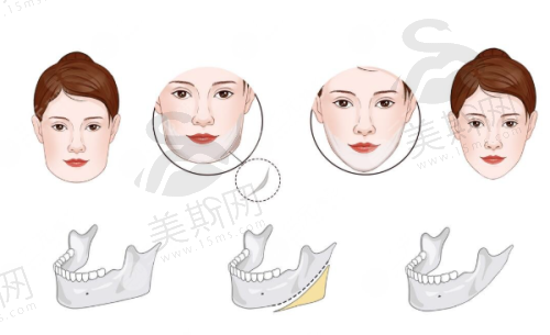 北京画美医院是国有还是私立医院?
