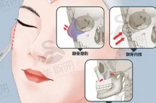 怎么预约杨东运
