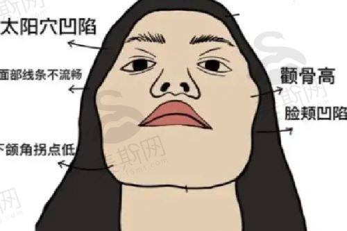 杭州阿波罗医院医生简介