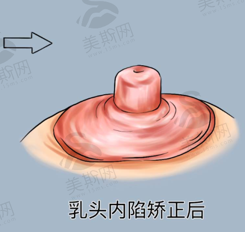 北京润美玉之光医疗美容