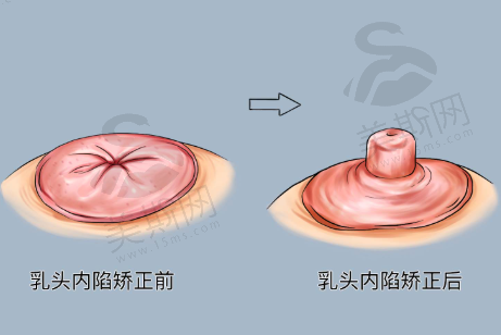 总结