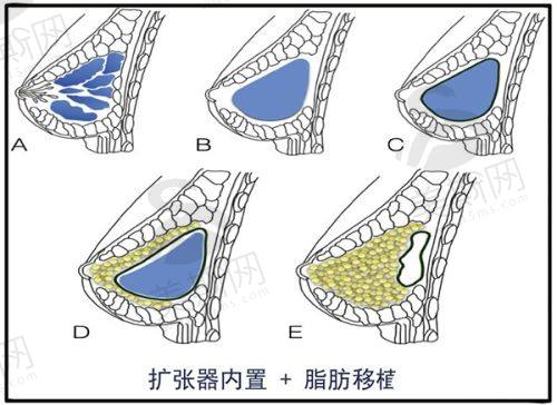 国内拉皮医院医生推荐及在线预约方式