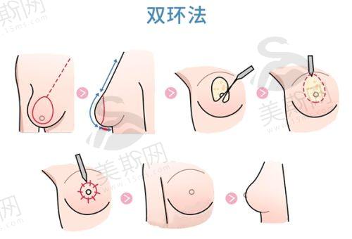 北京嘉禾医美医院