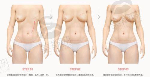 北京沃尔刘彦军整形美容