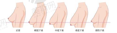 总结