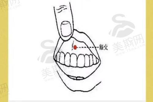 西安地区拉皮医院医生预约推荐