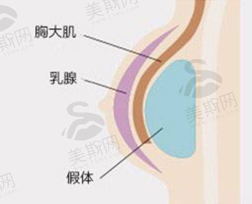 沈阳杏林吸脂、脂肪填充项目价格及医生推荐