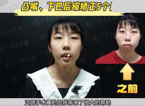 医院客服预约