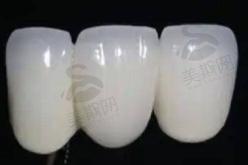 高端服务需求