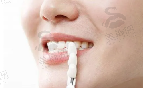 总结