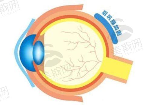 贵州省人民医院眼科做近视手术好不好？费用、专家排名、全飞秒手术可行性等情况揭秘