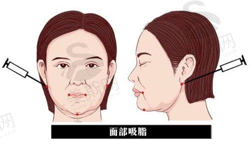 荔湾清奥当然可信，广州荔湾清奥中心正规可靠且收费合理，打消你对清奥真假的疑虑