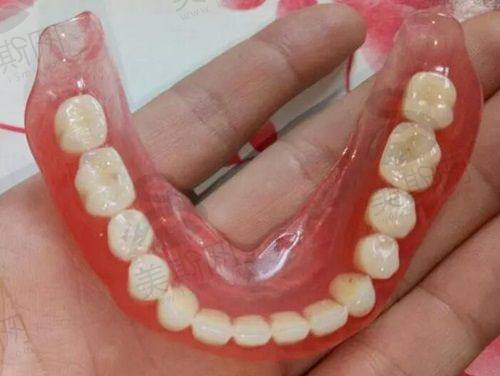 商丘美迪牙科矫正牙齿套餐内容