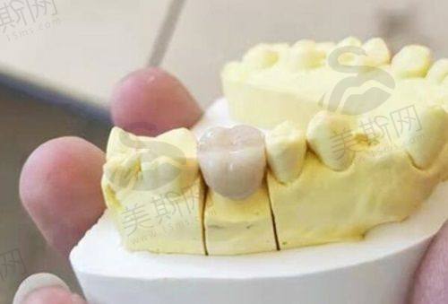 西安交大口腔医院网上挂号放号时间