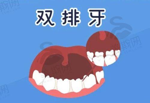 商丘美迪牙科的价格表曝光，金属矫正牙齿5480元起，拔牙多少钱？该牙科究竟怎么样？