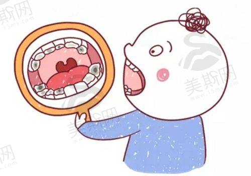 美国进口隐适美牙齿矫正