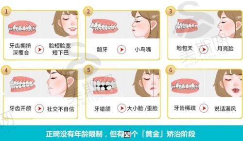 时代天使隐形矫正