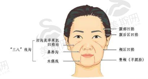 赵军舰吸脂靠谱在哪?直接上硬核亮点!