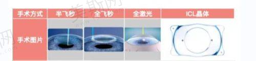 乌鲁木齐美尼康眼科医院预约挂号
