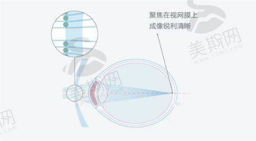 乌鲁木齐美尼康眼科医院诊疗项目